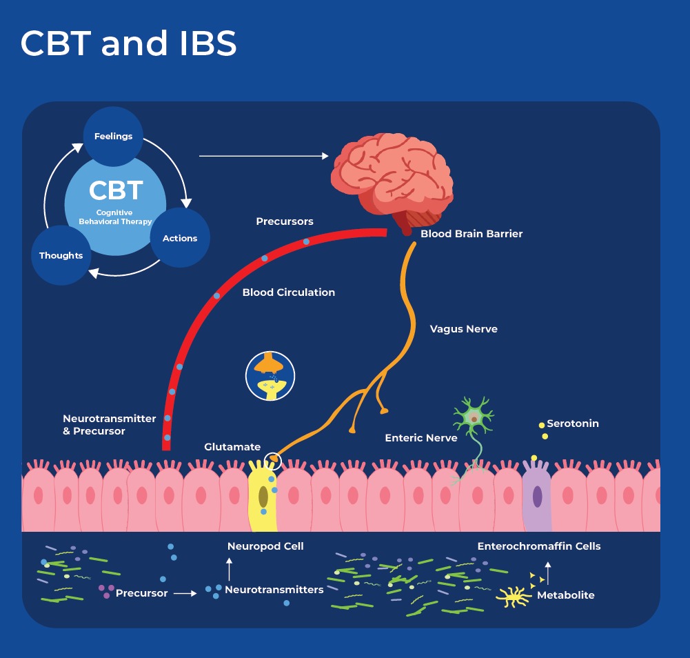 CBT and IBS
