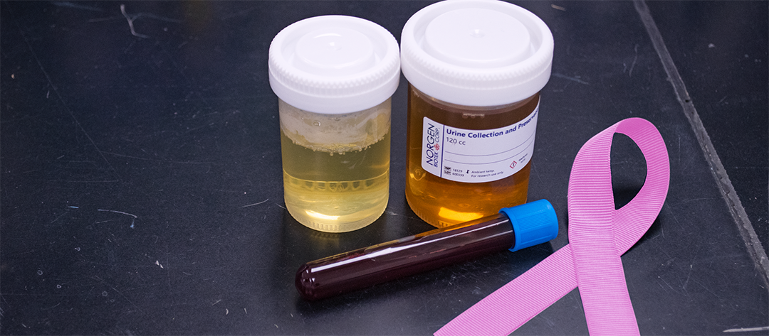 urine and blood samples with breast cancer pink ribbon