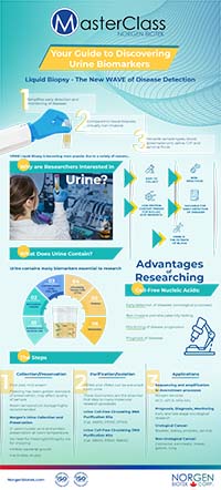 Urine Collection Infographic