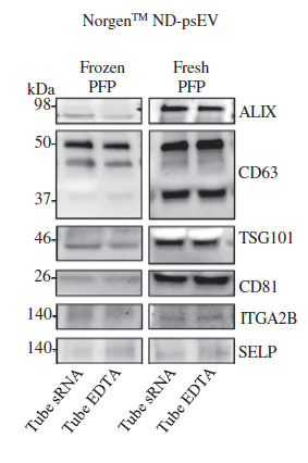 Figure 3. Western blot analysis of psEV isolated with the Norgen kit using EV markers (TSG101, CD81, ALIX, CD63) and platelet markers (ITGA2B and SELP).