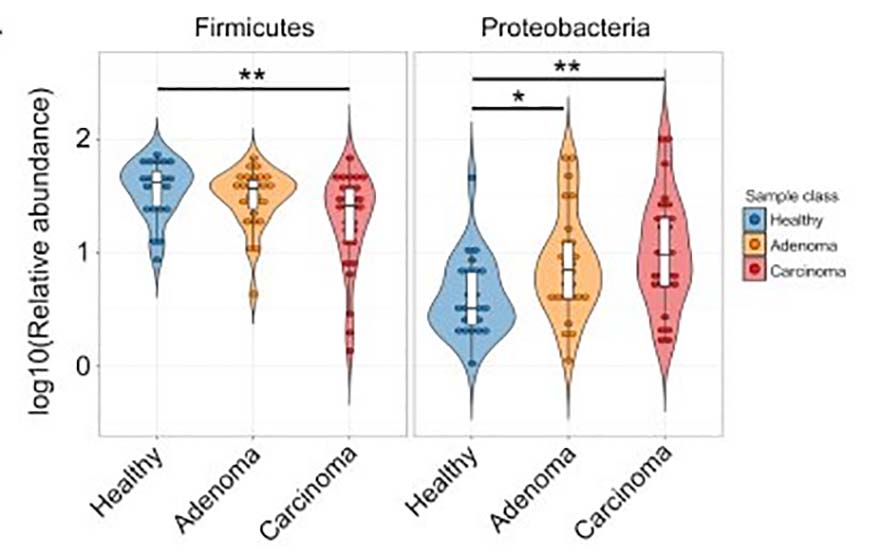 Figure 1. Relative abundances of differentially abundant bacterial phyla among healthy, adenoma, and carcinoma groups.