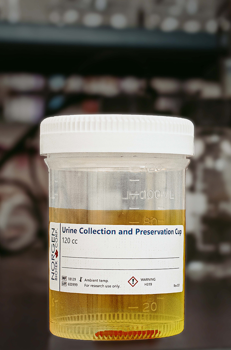 Norgen's Urine Collection and Preservation 120 cc Cup