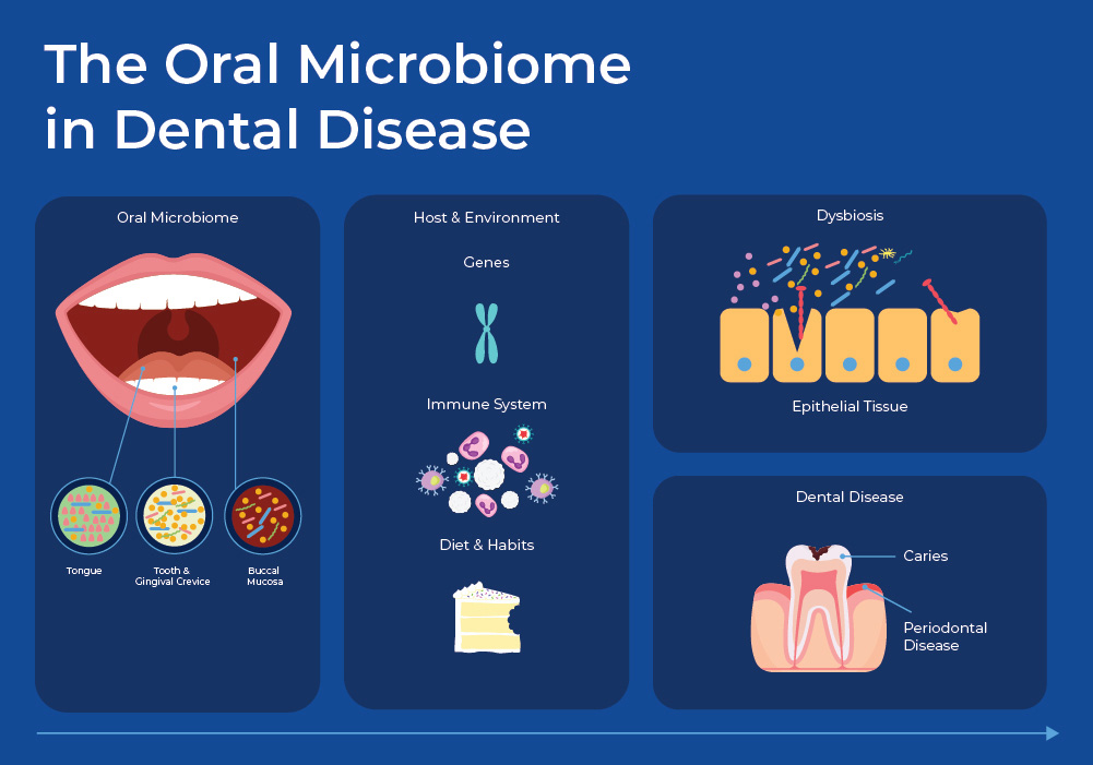 Figure 2 - The Oral Microbiome in Dental Disease