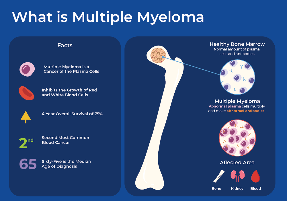 What is Multiple Myeloma