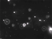 Exosomes under microscope