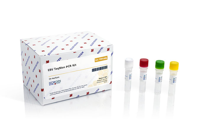EBV TaqMan PCR Kit Dx