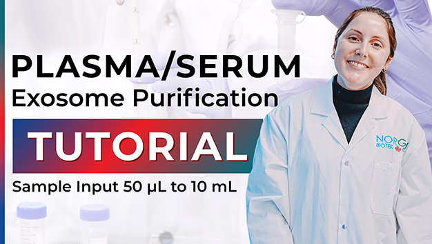 plasma serum exosome purification