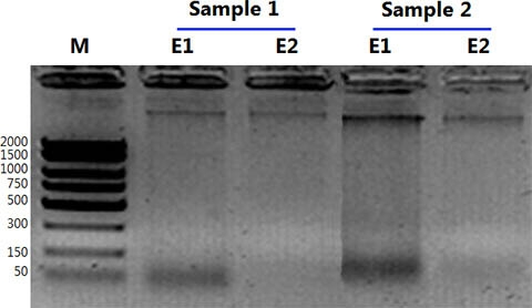 Figure 5. A Typical Agarose Gel Showing Total Urinary DNA Isolated from 1.5 mL of Urine using Norgen's Urine DNA Isolation Kit. 
