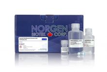 Synovial Fluid Bacterial Genomic DNA Purification Kit