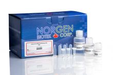 Norgen Biotek Urine Exosome RNA Isolation Kit