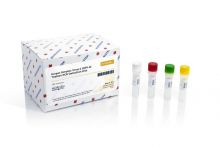 HSV-2 TaqMan PCR Kit (100 reactions)
