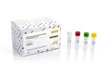Pneumocystis jirovecii Detection Kit (100 reactions)