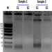 Figure 1. A Typical Agarose Gel Showing Total Urinary DNA