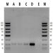 Figure 3. Circulating DNA Isolated from Urine