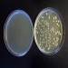 Figure 4. Gram Negative Bacteria in Urine