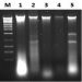 Fungi/Yeast Genomic DNA Isolation Kit Figure 1