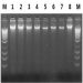 Figure 5. Resolution of DNA Isolated from Preserved Saliva Samples