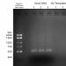 Figure 1: 16S V2-V3 PCR1 Amplification