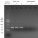 Figure 1: 16S V3-V5 PCR1 Amplification