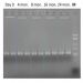 Figure 3. v3-v4 16s rRNA PCR amplification for Illumina MiSeq 16s rRNA library preparation.