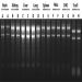Figure 11. Total RNA Purification 96-Well Kit