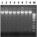 Figure 18. DNA Isolated from Blood Preserved in EDTA Anticoagulants