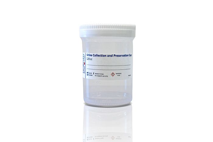 Urine Collection And Preservation Cup 120 Cc Cat 18129 Norgen Biotek Corp