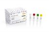 BKV TaqMan PCR Kit (100 reactions)